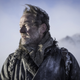 Conquered greyscale. Might not conquer frostbite. (Photo: Helen Sloan/HBO)
